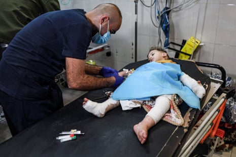 Injured Palestinian child evacuated from the Indonesian hospital in the north of the Gaza Strip receive care at Nasser hospital in the Palestinian territory’s southern city of Khan Yunis, amid ongoing battles between Israel and the Palestinian Hamas movement.