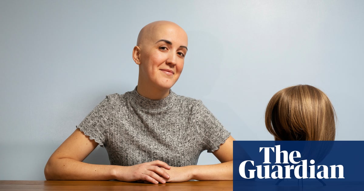 It Takes A Thick Skin To Rock A Bald Head Meet The Women