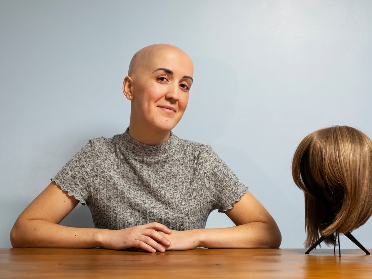 It takes a thick skin to rock a bald head': meet the women embracing hair  loss | Hair loss | The Guardian