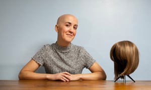 Alice Austin, who started losing her hair in primary school and stopped wearing her wigs when she became a mother.