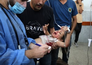 A critically injured child in distress is being taken for medical treatment in a hospital in Gaza City