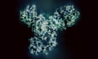 Drug that ‘melts away’ tumours could replace surgery for bowel cancer, say doctors