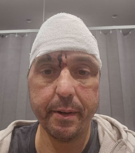 Michael Thorn with bandage on head