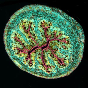 A cross-section of mouse intestine