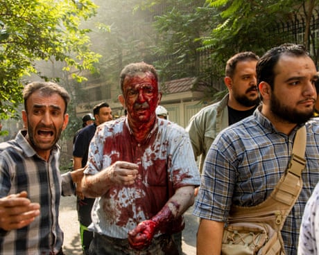 An injured man is helped to leave the scene after an explosion in central Tehran