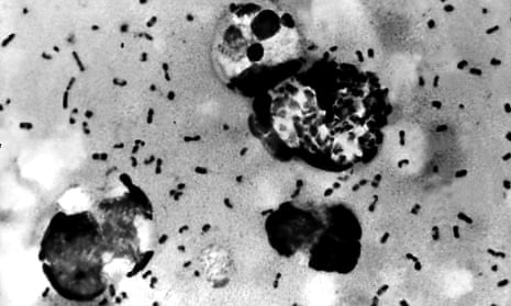 Bubonic plague bacteria taken from a patient