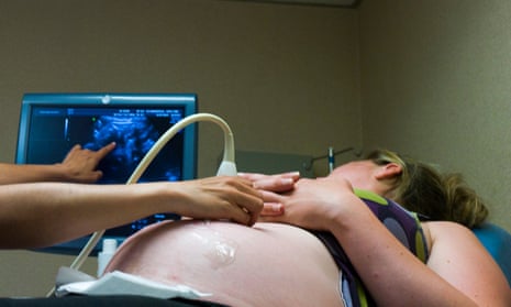 Pregnant women going for scans alone told they cannot film baby | Pregnancy | The Guardian