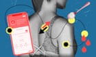 'Personalising stuff that doesn't matter': the trouble with the Zoe nutrition app