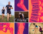 ‘I spent a week crying. I’ve never had an injury in my life!’ Why do so many fitness fans end up needing surgery?