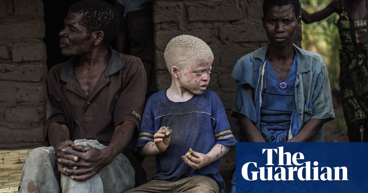 Priest among 12 people convicted of murder of Malawian man with albinism