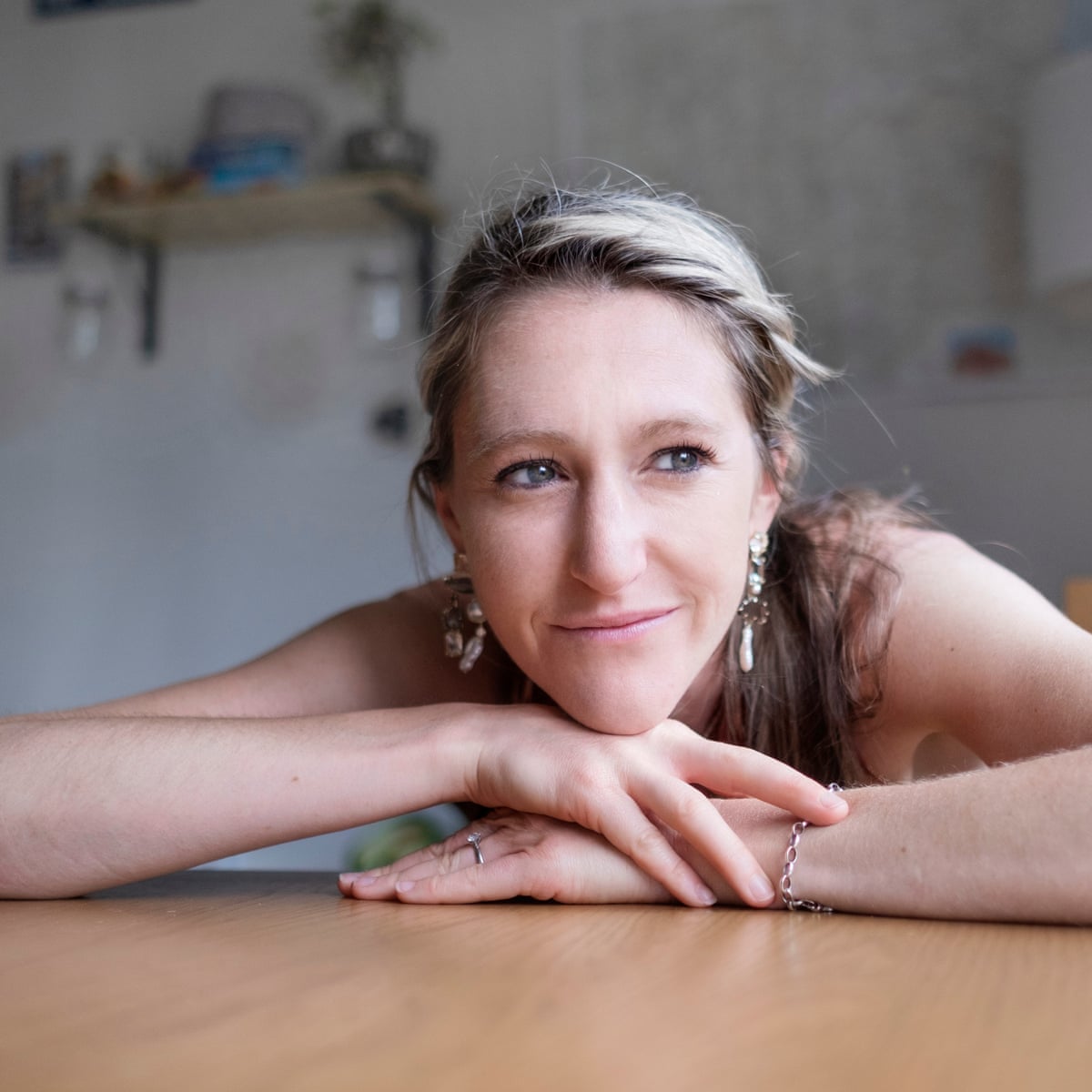 Hope Virgo: The Woman Who Survived Anorexia – And Began Dump The Scales |  Anorexia | The Guardian
