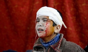 A Syrian child waits to receive medical treatment at a field hospital following the attacks on Monday in Eastern Ghouta.