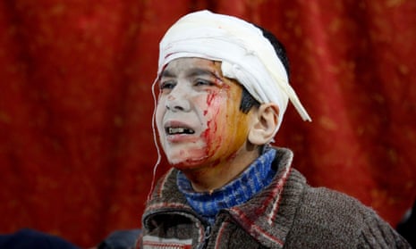 A Syrian kid waits to receive medical treatment at the field hospital