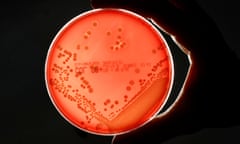  MRSA bacteria strain is seen in a petri dish in a microbiological laboratory in Berlin
