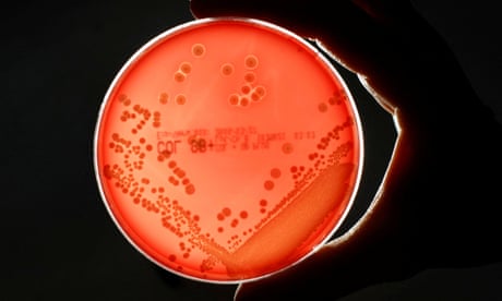 MRSA bacteria strain is seen in a petri dish in a microbiological laboratory in Berlin