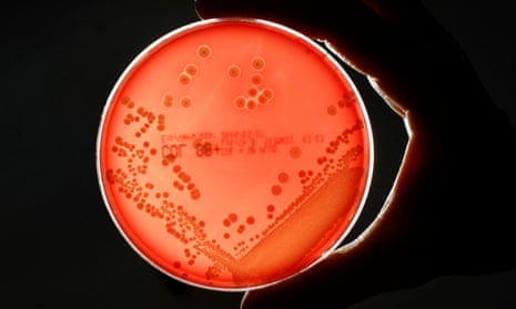  MRSA bacteria strain is seen in a petri dish in a microbiological laboratory in Berlin