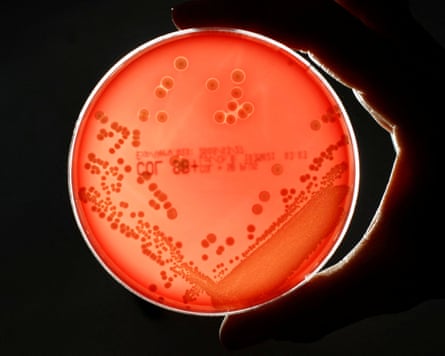 A bacteria strain in a petri dish