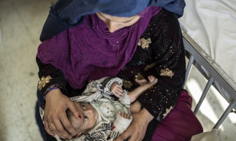 A woman holds her four-month-old baby as he undergoes treatment at the malnutrition ward of a hospital in Kabul, Afghanistan. Gordon Brown has warned of a growing humanitarian crisis.