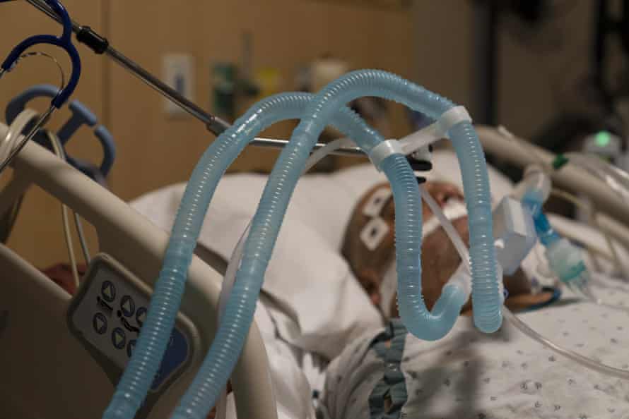 Ventilator tubes were attached to a Govt-19 patient at Providence Holy Cross Medical Center in the Mission Hills division of Los Angeles last month.