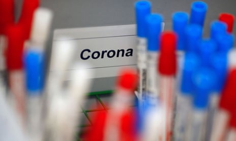 Plastic vials containing tests for the coronavirus are pictured at a medical laboratory in Cologne, Germany.