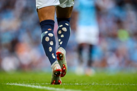 September 1: The ripped socks of Kyle Walker of Manchester City are seen during the Premier League match between Manchester City and Newcastle United.