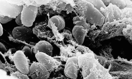 An electron micrograph depicting a mass of Yersinia pestis bacteria.