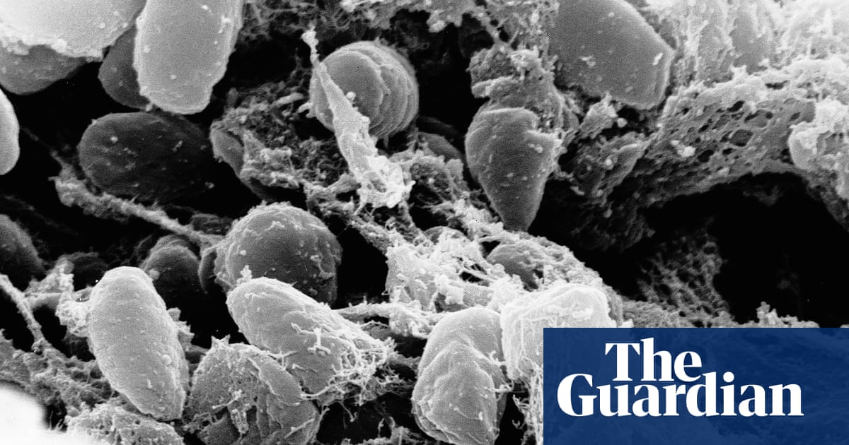 Two people diagnosed with pneumonic plague in China