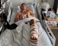 Nathan Cleary gives two thumbs up in hospital bed, his bandaged leg raised on a pillow