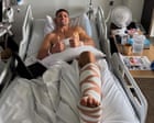 Nathan Cleary undergoes successful surgery on ankle injury from match