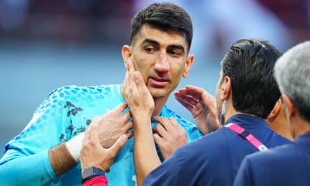 The Iran goalkeeper Alireza Beiranvand is treated for a head injury against England