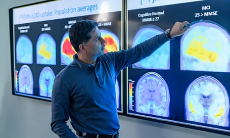 Brain scan images at Biogen’s headquarters in Cambridge, Massachusetts