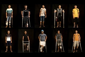 A photomontage shows Palestinians shot in the legs during protests at the Gaza strip’s border with Israel as they await treatment at a Gaza City clinic. Israeli forces have fired live rounds at rock-throwing demonstrators since March, targeting one part of the body more than any other: the legs.
