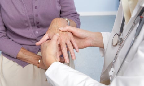 Rheumatoid arthritis, general practitioner examining patient's hands