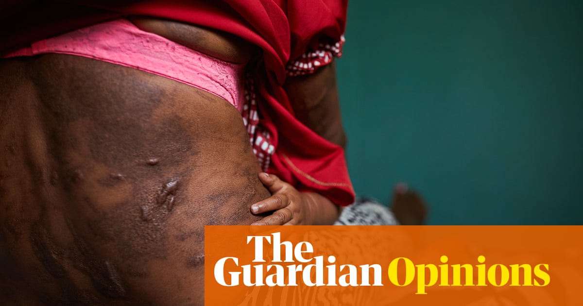 PNG must act now to stop the epidemic of violence against women and girls