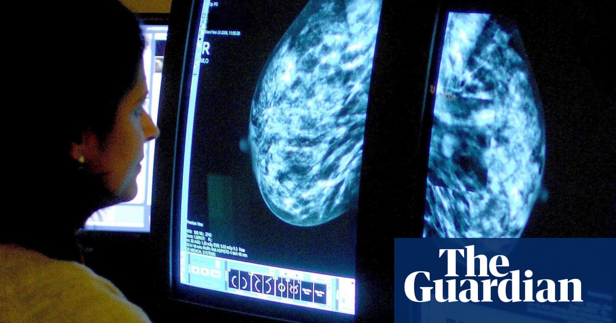 Women under 35 face higher risk of breast cancer spreading – study