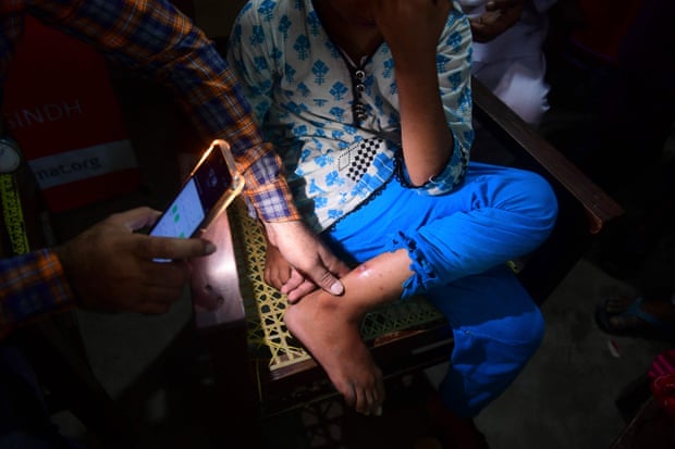 Sores on a girl's leg are examined by the light of a mobile phone