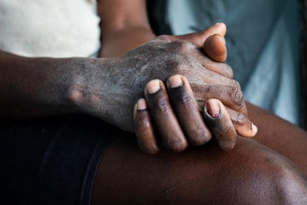 Wringing hands of an African-Caribbean woman in closeup.
