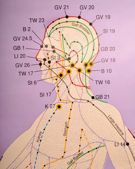 close up of acupuncture chart