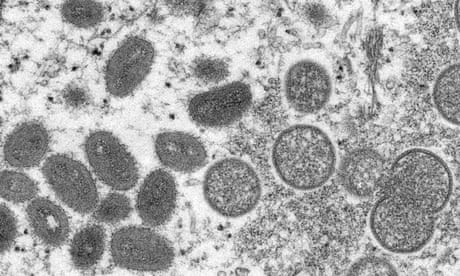 Mature, oval-shaped monkeypox virions, left, and spherical immature virions, right, obtained from a sample of human skin associated with the 2003 prairie dog outbreak. 