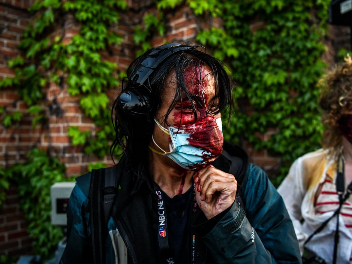 Protests About Police Brutality Are Met With Wave Of Police