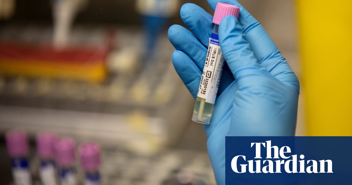 Spain reports second death related to monkeypox