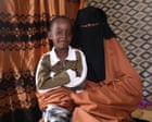 Guardian readers fund life-changing surgery for Somali boy injured in US airstrike