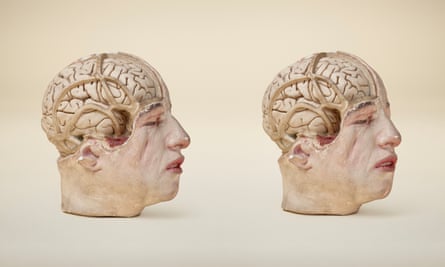 Anatomical cast or model of human head: ‘so lifelike that you might recognise him in the street’.