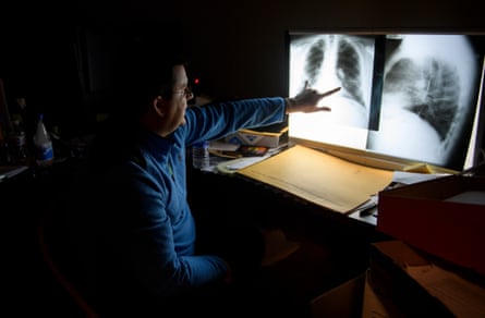 Dr Brandon Crum reads the chest x-rays of a miner in his office outside Pikeville, Kentucky.