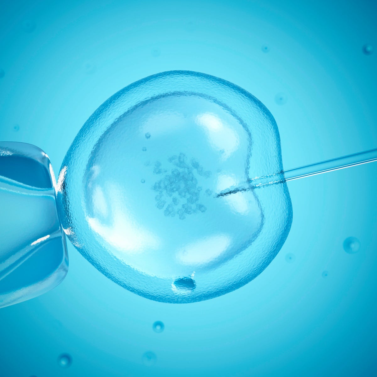 Couples Being Denied Ivf On Nhs Over Man S Age Or Weight