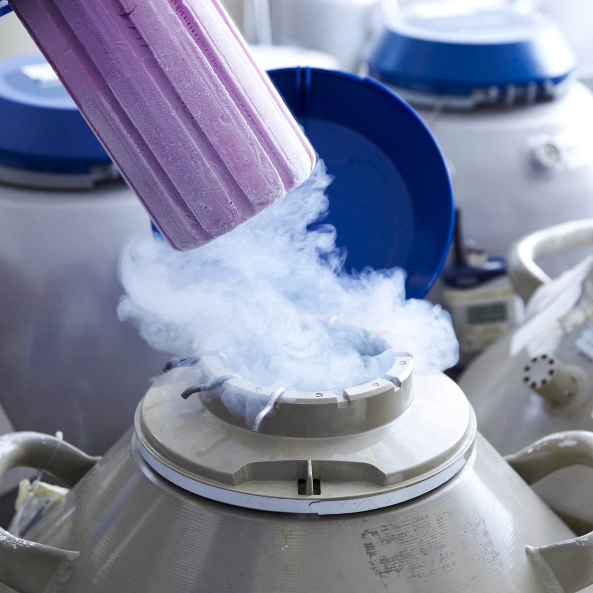 How much it cost to freeze your eggs