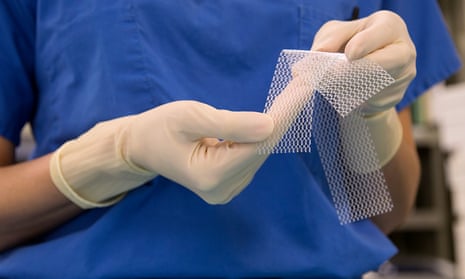 Vaginal mesh implants