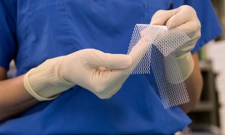 Plastic mesh used in pelvic surgery.