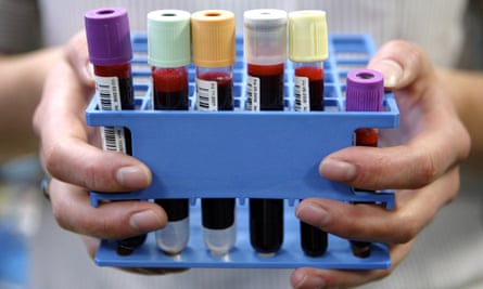 A collection of blood samples