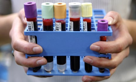 A collection of blood samples at the UK Biobank project in Manchester. 
